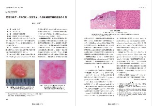 ダーモスコピー